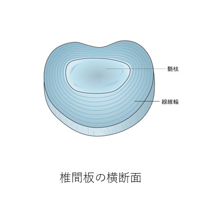 椎間板横断面