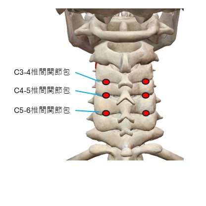 椎間関節包の位置